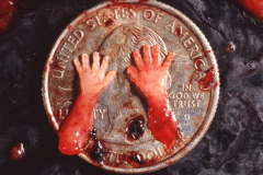 abortion-10-weeks